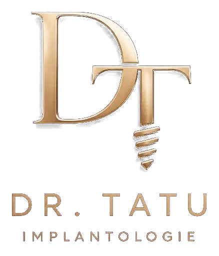 Dr. Tatu — Implantologie